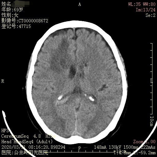 1596163795134809.jpg