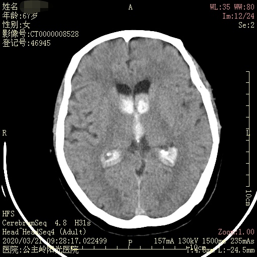 1596163795350665.jpg